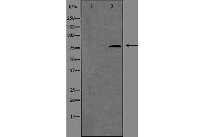 Western blot analysis of extracts from COLO cells using SLC9A7 antibody. (NHE7 Antikörper  (Internal Region))