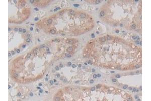 Detection of CAPN3 in Human Kidney Tissue using Polyclonal Antibody to Calpain 3 (CAPN3)