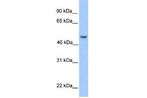 ASB6 antibody used at 1 ug/ml to detect target protein. (ASB6 Antikörper  (Middle Region))