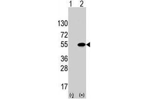 Western blot analysis of ATF4 (arrow) using rabbit ATF4 polyclonal antibody . (ATF4 Antikörper  (Ser245))