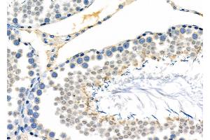 ABIN6262414 and ABIN6278847 at 1/100 staining Rat testis tissue by IHC-P.