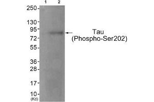 Western blot analysis of extracts from JK cells (Lane 2), using Tau (Phospho-Ser202) Antibody. (MAPT Antikörper  (pSer202))