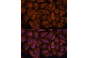 Immunofluorescence analysis of U-2 OS cells using NEXN antibody (ABIN6132932, ABIN6144546, ABIN6144547 and ABIN6217017) at dilution of 1:100. (NEXN Antikörper  (AA 516-675))