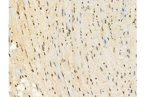 Phospho-MSH6 (Ser14) Antibody at 1/100 staining Mouse heart tissue by IHC-P.