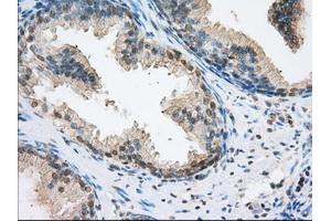 Immunohistochemical staining of paraffin-embedded pancreas tissue using anti-ERCC1 mouse monoclonal antibody. (ERCC1 Antikörper)