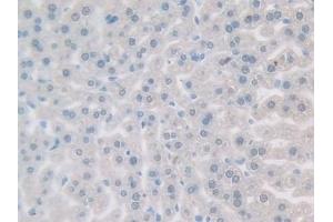 Immunohistochemistry (IHC) image for anti-Growth Differentiation Factor 5 (GDF5) (AA 358-495) antibody (ABIN7437095)