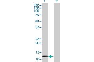 Western Blot analysis of FABP6 expression in transfected 293T cell line by FABP6 MaxPab polyclonal antibody. (FABP6 Antikörper  (AA 1-128))