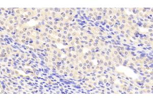 Immunohistochemistry (IHC) image for anti-Serpin Peptidase Inhibitor, Clade G (C1 Inhibitor), Member 1 (SERPING1) (AA 35-179) antibody (ABIN7438466)