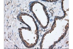 Immunohistochemical staining of paraffin-embedded Human liver tissue using anti-SNX9 mouse monoclonal antibody. (SNX9 Antikörper)