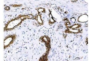 IHC analysis of BCKDHA using anti-BCKDHA antibody (ABIN7601223).