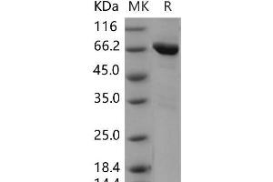 Western Blotting (WB) image for TEK Tyrosine Kinase, Endothelial (TEK) (AA 770-1122) (Active) protein (GST tag,His tag) (ABIN7320054) (TEK Protein (AA 770-1122) (GST tag,His tag))