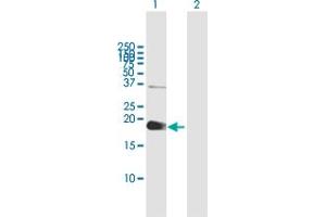 Western Blot analysis of ZCCHC13 expression in transfected 293T cell line by ZCCHC13 MaxPab polyclonal antibody. (ZCCHC13 Antikörper  (AA 1-166))