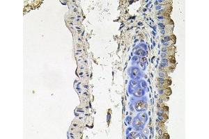 Immunohistochemistry of paraffin-embedded Mouse lung using NDUFA6 Polyclonal Antibody at dilution of 1:100 (40x lens).