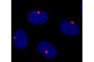 anti-Centrosomal Protein 290kDa (CEP290) (AA 2429-2479) antibody