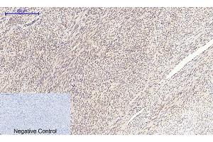 Immunohistochemical analysis of paraffin-embedded human uterus tissue. (c-MYC Antikörper  (AA 360-440))