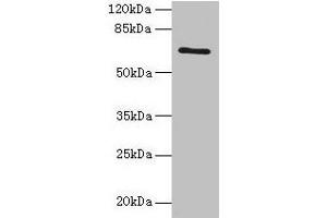 Western blot All lanes: HEATR9 antibody at 1. (C17orf66 Antikörper  (AA 1-219))