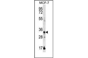 Western blot analysis of EVPLL Antibody (Center) in MCF-7 cell line lysates (35ug/lane).