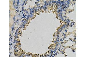Immunohistochemistry of paraffin-embedded Mouse lung using PSAT1 Polyclonal Antibody at dilution of 1:100 (40x lens). (PSAT1 Antikörper)