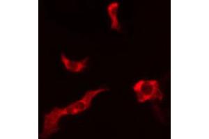 ABIN6266975 staining LOVO cells by IF/ICC. (ATPBD3 Antikörper  (C-Term))