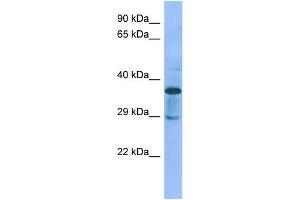 Host:  Rabbit  Target Name:  C1galt1c1  Sample Type:  Rat pancreas lysates  Antibody Dilution:  1. (C1GALT1C1 Antikörper  (N-Term))