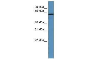 MAGED2 antibody used at 0. (MAGED2 Antikörper  (N-Term))