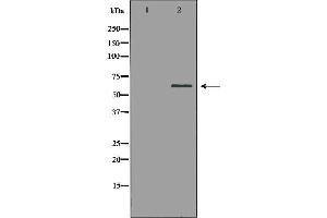 Western blot analysis of extracts of mouse kidney, using PAK1 antibody. (PAK1 Antikörper  (N-Term))