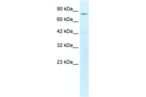 Western Blotting (WB) image for anti-Activating Transcription Factor 6 beta (ATF6B) antibody (ABIN2460387) (ATF6B Antikörper)