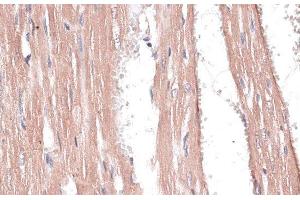 Immunohistochemistry of paraffin-embedded Rat heart using COL11A1 Polyclonal Antibody at dilution of 1:100 (40x lens). (COL11A1 Antikörper)