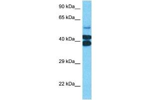 Host:  Rabbit  Target Name:  PTOV1  Sample Type:  Jurkat Whole Cell lysates  Antibody Dilution:  0. (PTOV1 Antikörper  (N-Term))