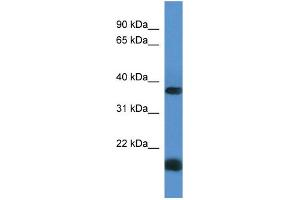 Western Blotting (WB) image for anti-Rhomboid Domain Containing 1 (RHBDD1) (C-Term) antibody (ABIN2788470) (RHBDD1 Antikörper  (C-Term))