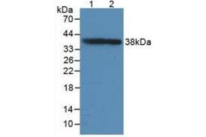 Figure. (GAP43 Antikörper  (AA 8-226))