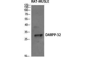 Western Blot (WB) analysis of specific cells using DARPP-32 Polyclonal Antibody. (DARPP32 Antikörper  (Tyr785))