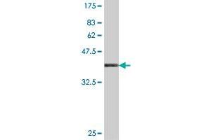 Western Blotting (WB) image for anti-Adaptor-Related Protein Complex 3, beta 1 Subunit (AP3B1) (AA 995-1094) antibody (ABIN563682)