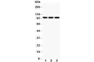 Western blot testing of NFKB2 antibody and Lane 1:  Jurkat;  2: A549;  3: MCF-7;  Expected size: 52 and 100KD, depending on sample tested (NFKB2 Antikörper  (AA 1-340))