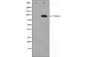 Western blot analysis on HeLa cell lysate using PTPN22 Antibody,The lane on the left is treated with the antigen-specific peptide. (PTPN22 Antikörper  (C-Term))