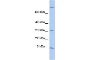 WB Suggested Anti-MGP Antibody Titration:  0. (MGP Antikörper  (Middle Region))