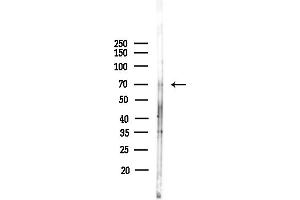 anti-Bromodomain Containing 7 (BRD7) (Internal Region) antibody