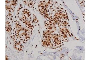 Immunohistochemistry (IHC) image for anti-PTK2 Protein tyrosine Kinase 2 (PTK2) (pTyr397) antibody (ABIN6256730)