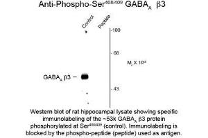 Image no. 1 for anti-gamma-aminobutyric Acid (GABA) A Receptor, beta 2 (GABRB2) (pSer408), (Ser409) antibody (ABIN956760) (GABRB2 Antikörper  (pSer408, Ser409))
