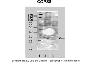 Sample Type: 1. (COPS7A Antikörper  (Middle Region))