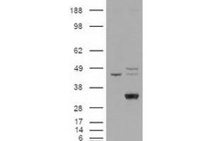 Western blot analysis of LIPG in cell lysates that were transfected with the pCMV6-ENTRY control or pCMV6-ENTRY LIPG cDNA using LIPG polyclonal antibody . (LIPG Antikörper  (C-Term))