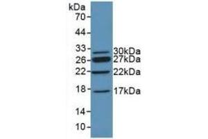 Detection of Recombinant CHD3, Mouse using Polyclonal Antibody to Chromodomain Helicase DNA Binding Protein 3 (CHD3) (CHD3 Antikörper  (AA 1613-1820))