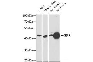Western blot analysis of extracts of various cell lines using GIPR Polyclonal Antibody at dilution of 1:1000. (GIPR Antikörper)
