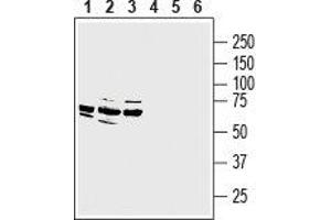 Western blot analysis of rat dorsal root ganglion lysate (lanes 1 and 4), mouse (lanes 2 and 5) and rat (lanes 3 and 6) brain membranes: - 1-3. (MRGPRE Antikörper  (3rd Intracellular Loop))