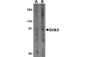 Western Blotting (WB) image for anti-Glutamate Receptor, Ionotropic, Kainate 3 (GRIK3) (N-Term) antibody (ABIN1031396) (GRIK3 Antikörper  (N-Term))