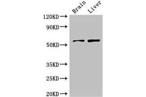 Western Blot Positive WB detected in: Mouse brain tissue, Rat liver tissue All lanes: KCNA1 antibody at 3 μg/mL Secondary Goat polyclonal to rabbit IgG at 1/50000 dilution Predicted band size: 57 kDa Observed band size: 57 kDa (KCNA1 Antikörper  (AA 7-150))