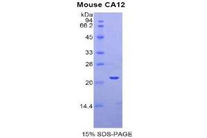 SDS-PAGE (SDS) image for Carbonic Anhydrase 12 (CA12) (AA 161-318) protein (His tag) (ABIN1877243)