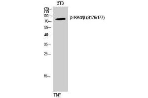 Western Blotting (WB) image for anti-IKK-alpha /IKK-beta (pSer176), (pSer177) antibody (ABIN3182040) (IKK-alpha /IKK-beta Antikörper  (pSer176, pSer177))