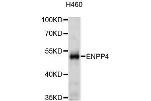 Western blot analysis of extracts of H460 cells, using ENPP4 antibody (ABIN5972569) at 1:3000 dilution. (ENPP4 Antikörper)