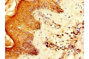 Immunohistochemistry of paraffin-embedded human skin tissue using ABIN7142567 at dilution of 1:100 (RPS6 Antikörper  (AA 35-229))
